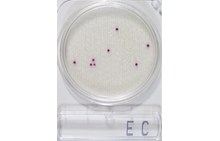 Compact Dry EC | E.coli og koliforme