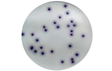 Vannagar CCA | E.coli & Koliforme i vann