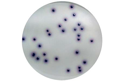CCA agar E.coli bilde