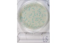 Compact Dry LS | Listeria spp
