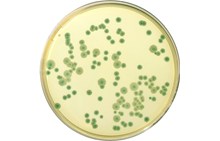 COMPASS agar | Bacillus cereus