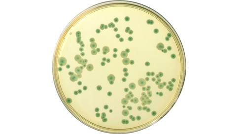 Enklere og raskere deteksjon av Bacillus cereus