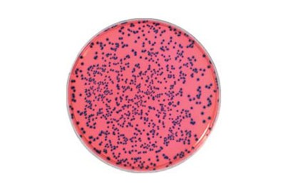 E.coli O157H7