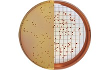 KF Streptococcus agar