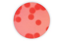 Mossel MYP agar | Bacillus cereus