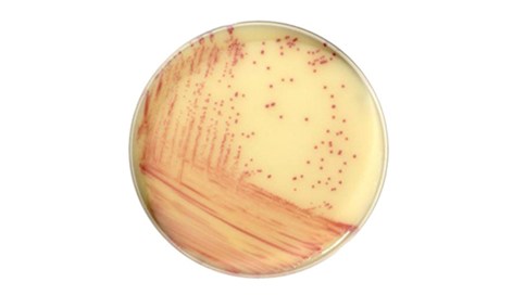 Rask og enkel påvisning av resistente bakterier!