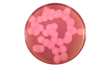 MYP agar | Bacillus cereus