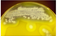 PEMBA agar | Bacillus cereus