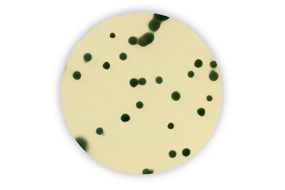 TSC uten D-Cycloserine agar